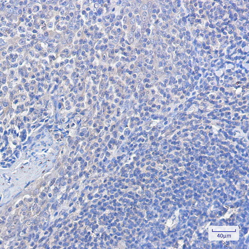 Rabbit Monoclonal Antibody to FOXO1