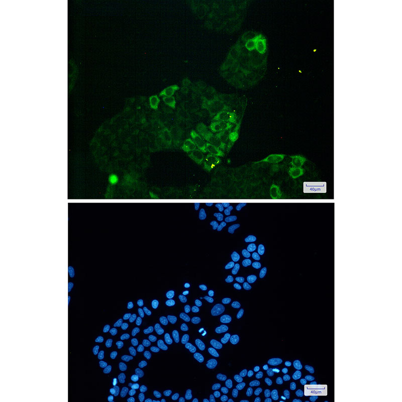 Rabbit Monoclonal Antibody to Cyclin B1