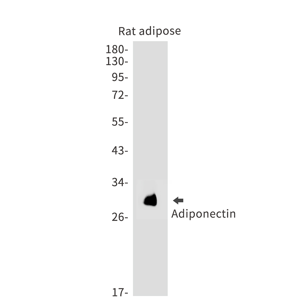 Adiponectin