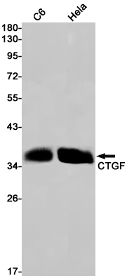 CTGF