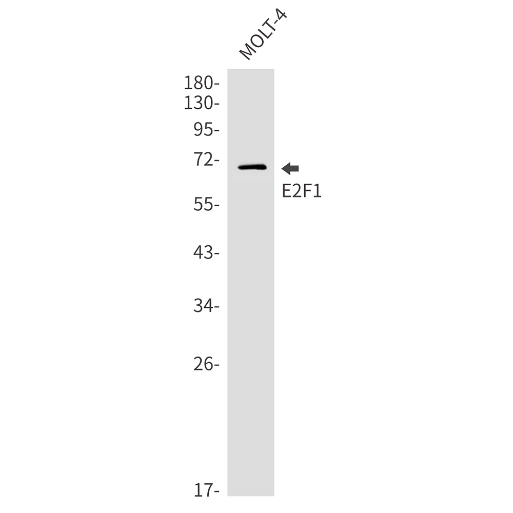 E2F1