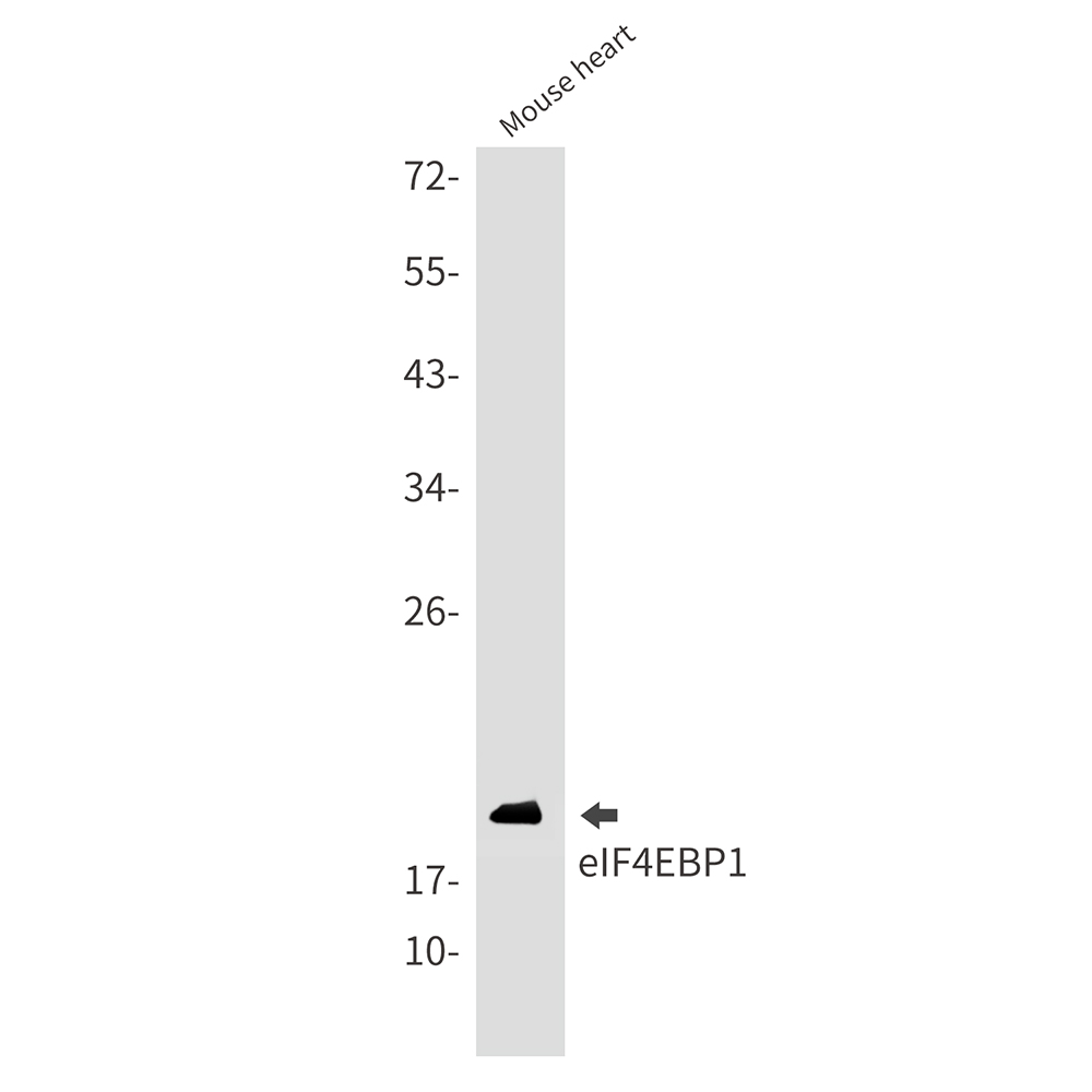 4E BP1