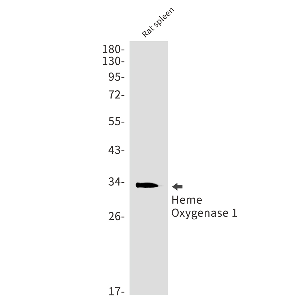 Heme Oxygenase 1