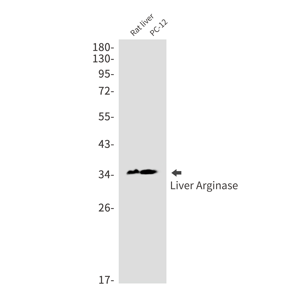 Liver Arginase