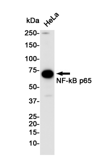 NF-KB p65
