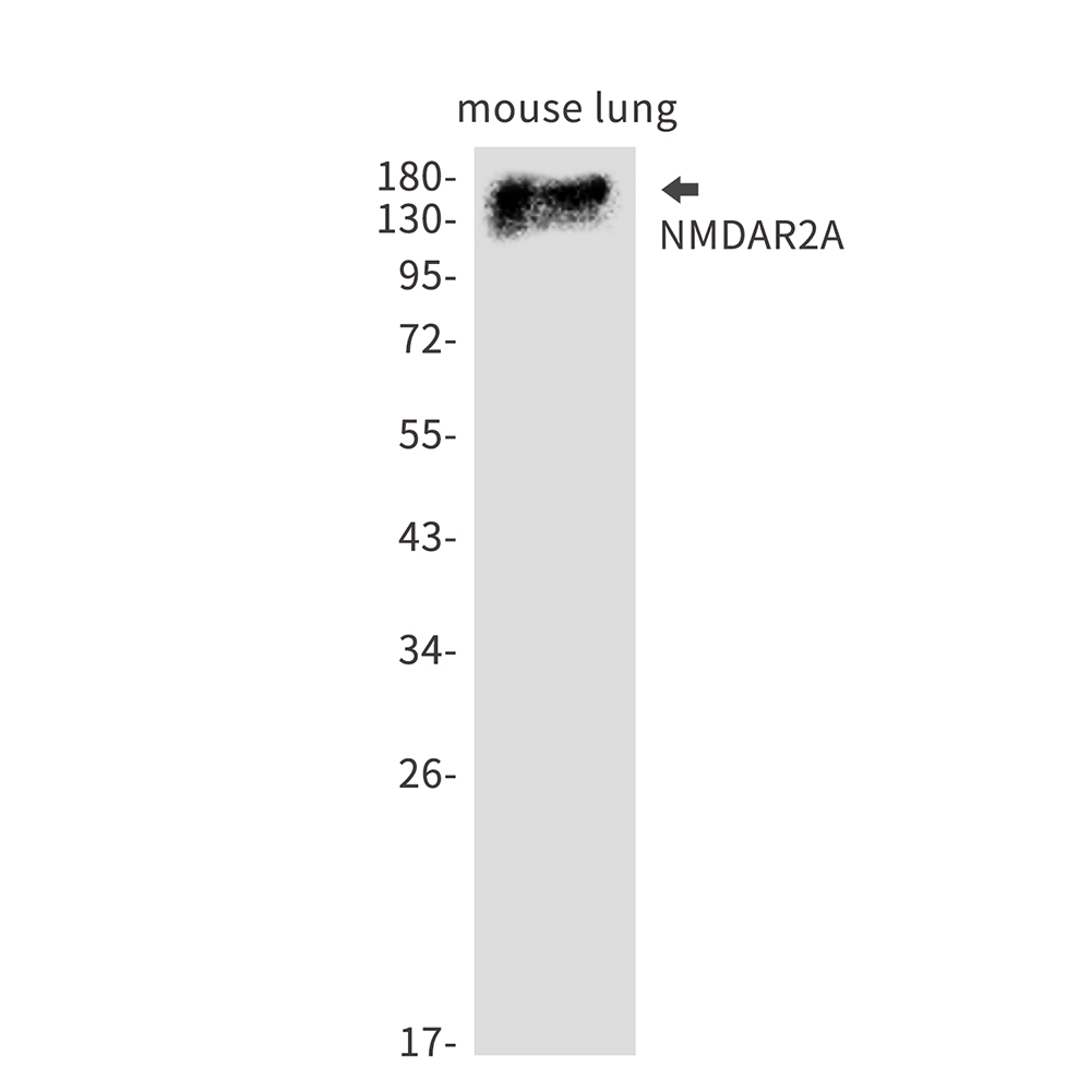 NMDAR2A