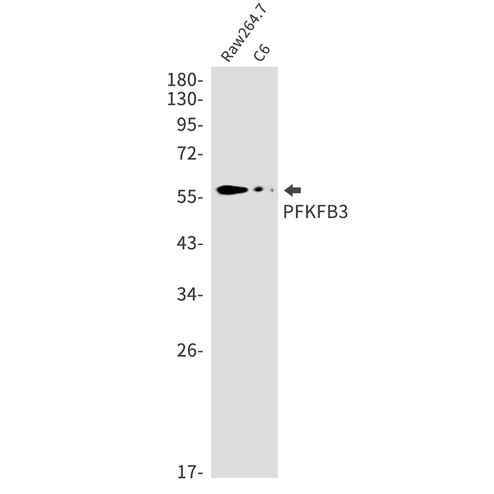 PFKFB3