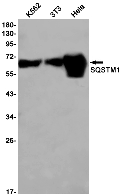 SQSTM1/p62
