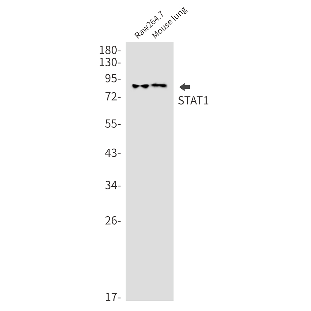 STAT1