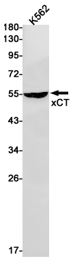 xCT