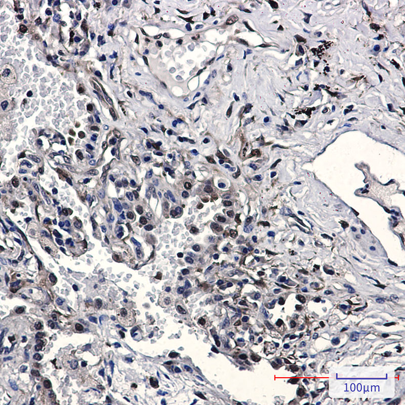 Rabbit Monoclonal Antibody to Nampt