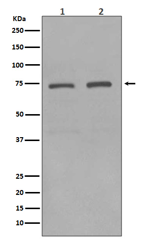 KIFC1