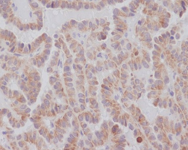 Rabbit Monoclonal Antibody to KIFC1 