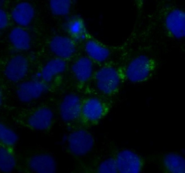 Rabbit Monoclonal Antibody to Caveolin-1 