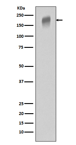 VEGF Receptor 1
