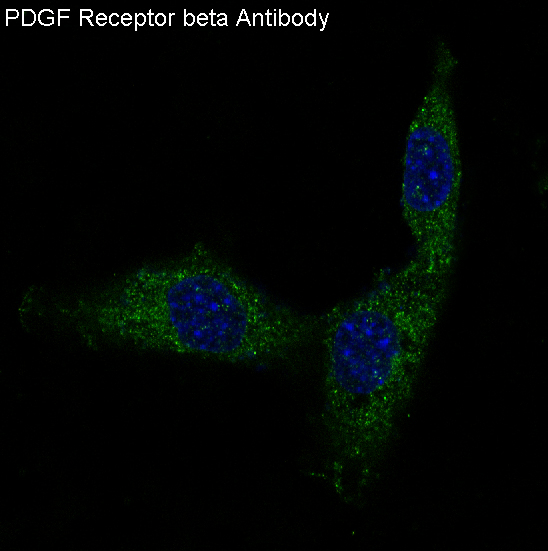 Rabbit Polyclonal Antibody to PDGFR beta