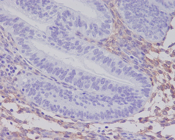 Rabbit Polyclonal Antibody to PDGFR beta