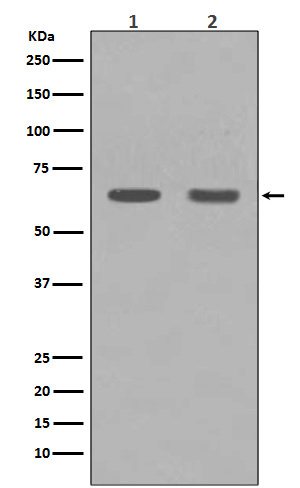 HDAC1