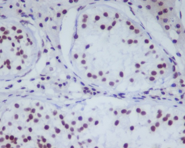 Rabbit Monoclonal Antibody to HDAC1 