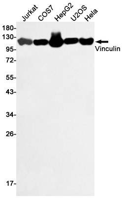 Vinculin