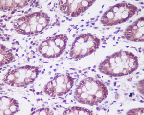 Rabbit Monoclonal Antibody to CSNK2A1 alpha 