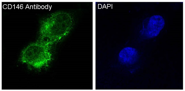 Rabbit Polyclonal Antibody to CD146