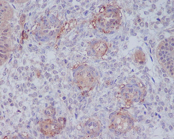 Rabbit Polyclonal Antibody to CD146