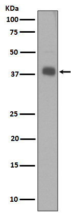 Synaptophysin