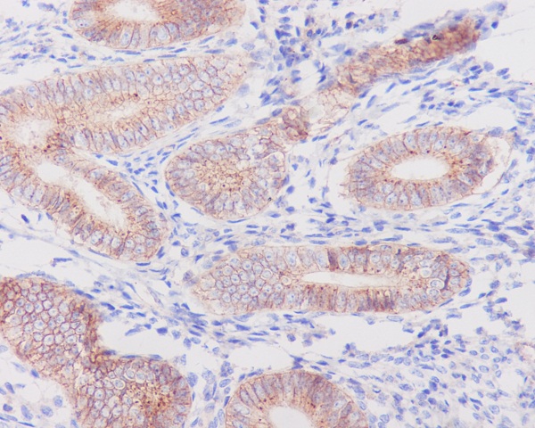 Rabbit Polyclonal Antibody to Flotillin 1