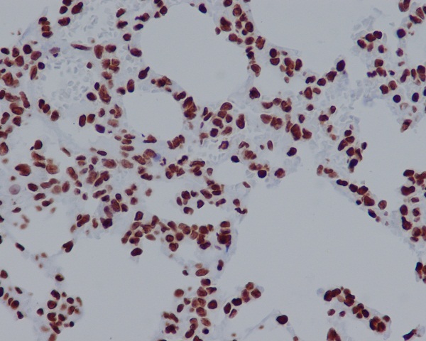 Rabbit Polyclonal Antibody to Histone H2A.X