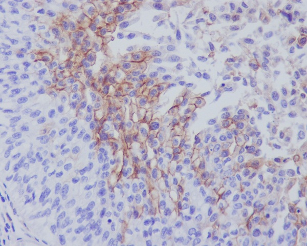 Rabbit Polyclonal Antibody to Thrombomodulin