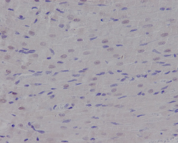 Rabbit Monoclonal Antibody to Nibrin 