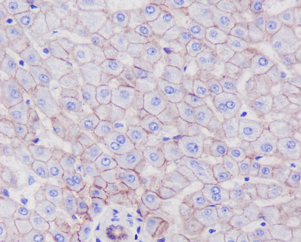 Rabbit Monoclonal Antibody to SR-BI 