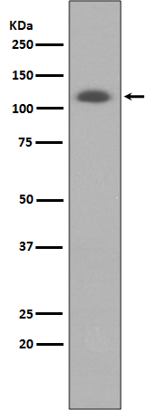 ABCG1