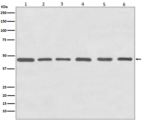 gamma Tubulin