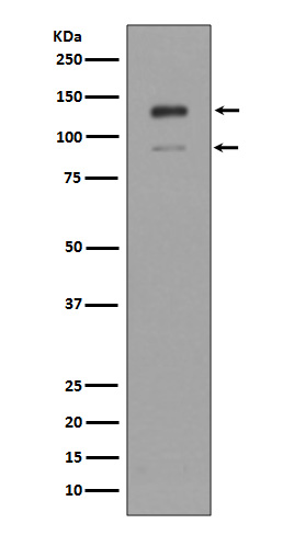 Interferon alpha/beta Receptor 1