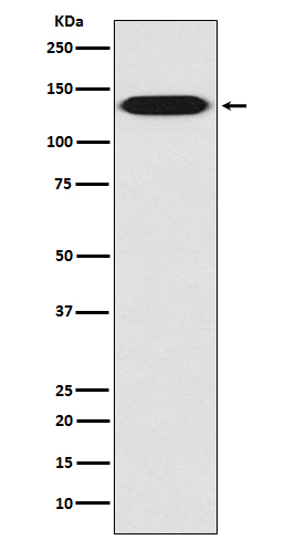 Integrin beta 1