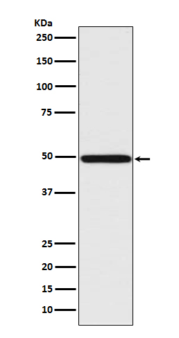 IRF1