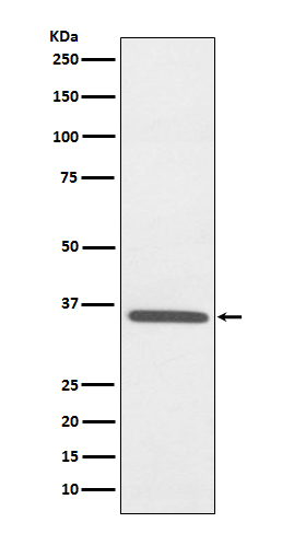 Fibrillarin