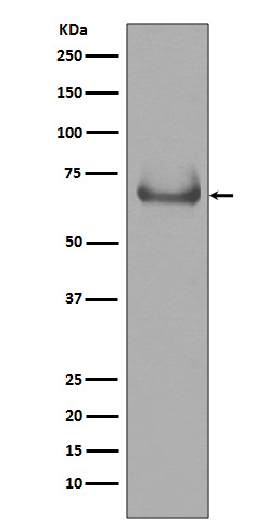 Lamin B Receptor