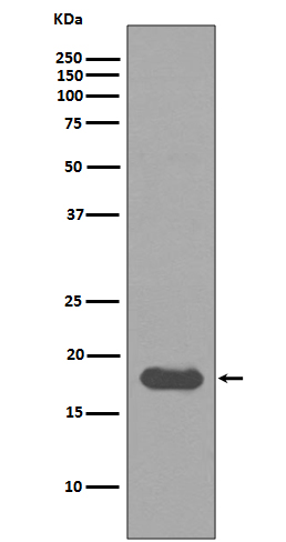 SUMO Conjugating Enzyme UBC9