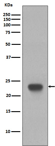 CD3 epsilon