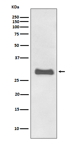 Prion Protein