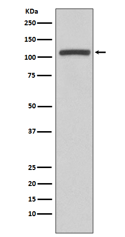 PI3 Kinase p110 beta