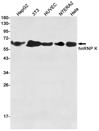 hnRNP K