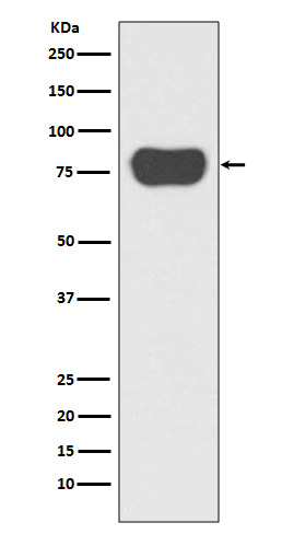 Cortactin
