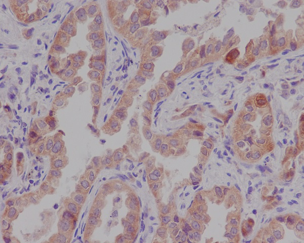 Rabbit Polyclonal Antibody to CTNNA1
