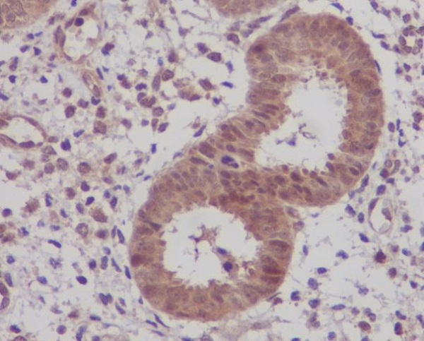 Rabbit Polyclonal Antibody to IKB beta