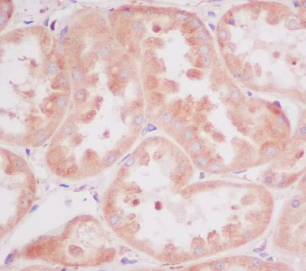 Rabbit Polyclonal Antibody to RPS20