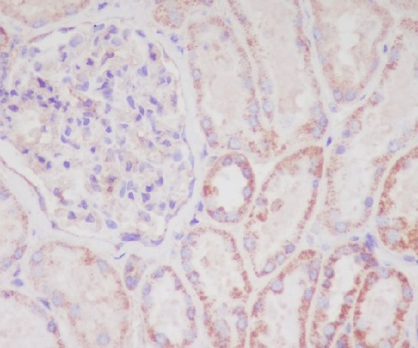 Rabbit Polyclonal Antibody to SMAC